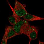 DACT3 Polyclonal Antibody