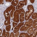 DACT3 Antibody in Immunohistochemistry (Paraffin) (IHC (P))