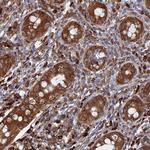 BPIFB6 Antibody in Immunohistochemistry (Paraffin) (IHC (P))