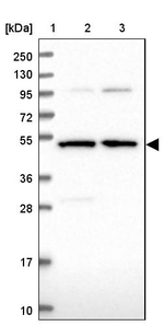 BPIFB6 Antibody in Western Blot (WB)