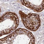 DEFB119 Polyclonal Antibody