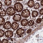 UQCRB Polyclonal Antibody