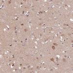 SAMD4A Antibody in Immunohistochemistry (Paraffin) (IHC (P))