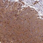 C5orf22 Antibody in Immunohistochemistry (Paraffin) (IHC (P))