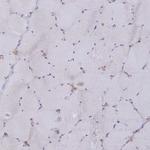 HS2ST1 Antibody in Immunohistochemistry (Paraffin) (IHC (P))