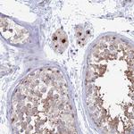 HS2ST1 Antibody in Immunohistochemistry (Paraffin) (IHC (P))