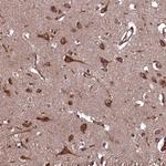 PLA2G4C Antibody in Immunohistochemistry (Paraffin) (IHC (P))