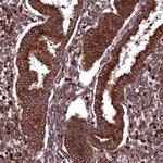 PLA2G4C Antibody in Immunohistochemistry (Paraffin) (IHC (P))
