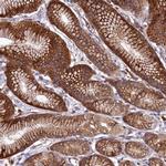 PLA2G4C Antibody in Immunohistochemistry (Paraffin) (IHC (P))