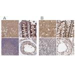 SORBS1 Polyclonal Antibody