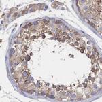 SORBS1 Antibody in Immunohistochemistry (IHC)