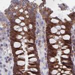 SORBS1 Antibody in Immunohistochemistry (IHC)