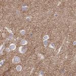 SORBS1 Antibody in Immunohistochemistry (IHC)