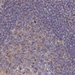 SORBS1 Antibody in Immunohistochemistry (IHC)