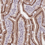 C19orf28 Antibody in Immunohistochemistry (Paraffin) (IHC (P))