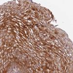 DEFB125 Polyclonal Antibody