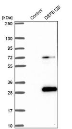DEFB125 Antibody in Western Blot (WB)