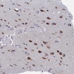 PGP Antibody in Immunohistochemistry (Paraffin) (IHC (P))