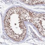 PGP Antibody in Immunohistochemistry (Paraffin) (IHC (P))