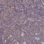 PGP Polyclonal Antibody