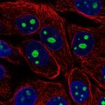 KRI1 Polyclonal Antibody