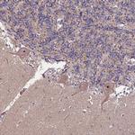 KRI1 Antibody in Immunohistochemistry (Paraffin) (IHC (P))