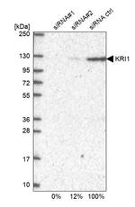 KRI1 Antibody in Western Blot (WB)