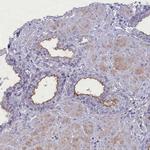 MPV17L2 Polyclonal Antibody