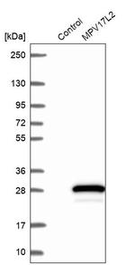 MPV17L2 Antibody in Western Blot (WB)