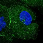 FAM193A Polyclonal Antibody