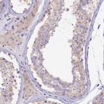 FAM193A Antibody in Immunohistochemistry (Paraffin) (IHC (P))