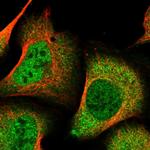 DDI2 Polyclonal Antibody