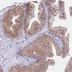 DDI2 Antibody in Immunohistochemistry (Paraffin) (IHC (P))