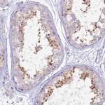 MBD3L1 Polyclonal Antibody