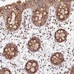 SMIM7 Antibody in Immunohistochemistry (Paraffin) (IHC (P))