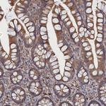 FILIP1L Antibody in Immunohistochemistry (Paraffin) (IHC (P))