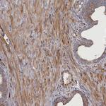 FILIP1L Polyclonal Antibody