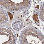 FILIP1L Antibody in Immunohistochemistry (Paraffin) (IHC (P))