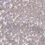 FILIP1L Antibody in Immunohistochemistry (Paraffin) (IHC (P))