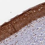 TMUB2 Antibody in Immunohistochemistry (Paraffin) (IHC (P))