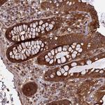 TMUB2 Antibody in Immunohistochemistry (Paraffin) (IHC (P))