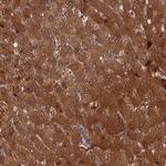 TMUB2 Antibody in Immunohistochemistry (Paraffin) (IHC (P))