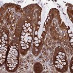 TMUB2 Antibody in Immunohistochemistry (IHC)