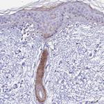 COL6A5 Antibody in Immunohistochemistry (IHC)