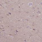 FSD1 Polyclonal Antibody