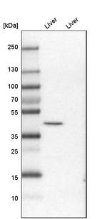 PRDM12 Antibody in Western Blot (WB)