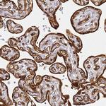 KIF7 Polyclonal Antibody