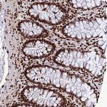 INO80E Antibody in Immunohistochemistry (Paraffin) (IHC (P))