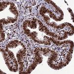 INO80E Antibody in Immunohistochemistry (Paraffin) (IHC (P))