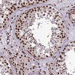 INO80E Antibody in Immunohistochemistry (Paraffin) (IHC (P))